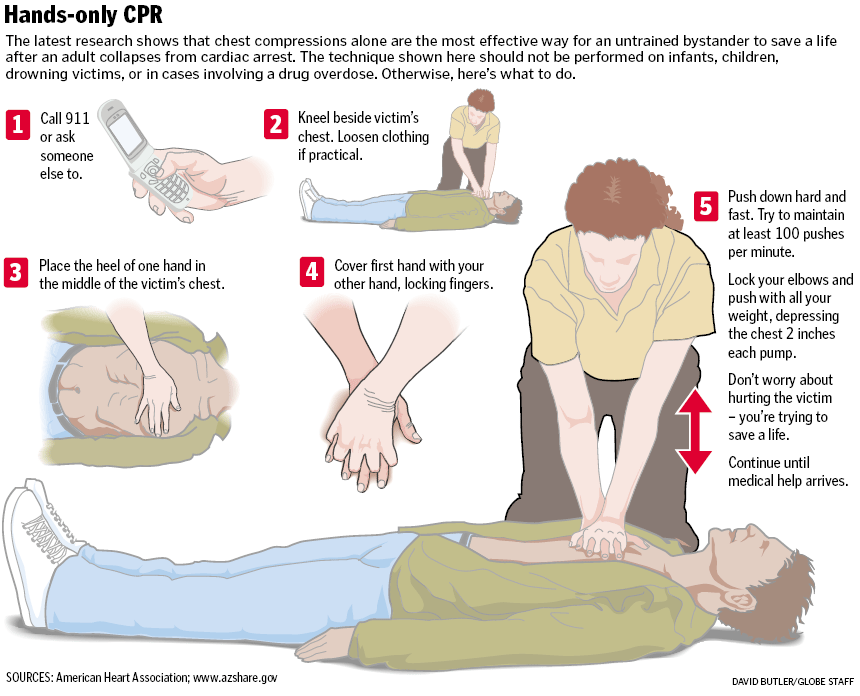 CPR方法